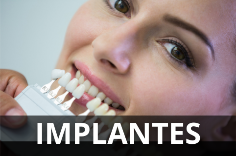 Implantes