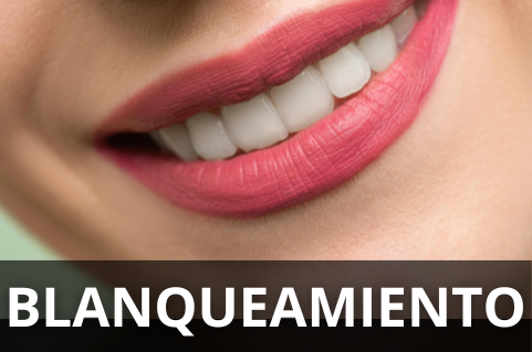 Implantes